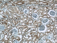 11911-1-AP - Uromodulin (UMOD)