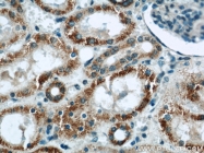 11911-1-AP - Uromodulin (UMOD)