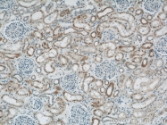 11911-1-AP - Uromodulin (UMOD)