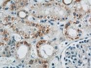 11911-1-AP - Uromodulin (UMOD)