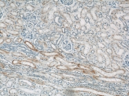 11911-1-AP - Uromodulin (UMOD)