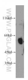 11911-1-AP - Uromodulin (UMOD)