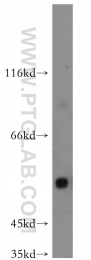 11911-1-AP - Uromodulin (UMOD)