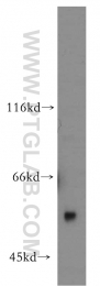 11911-1-AP - Uromodulin (UMOD)