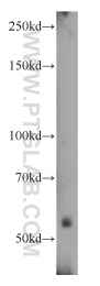 11911-1-AP - Uromodulin (UMOD)