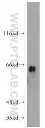 11911-1-AP - Uromodulin (UMOD)