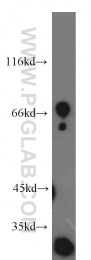 11911-1-AP - Uromodulin (UMOD)