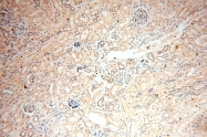 16905-1-AP - UNC13D