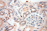 16905-1-AP - UNC13D