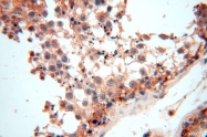 16905-1-AP - UNC13D