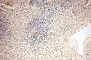 16905-1-AP - UNC13D