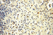 16905-1-AP - UNC13D