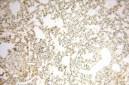 16905-1-AP - UNC13D