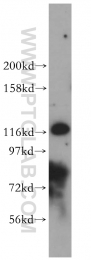 16905-1-AP - UNC13D