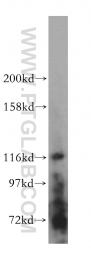 16905-1-AP - UNC13D