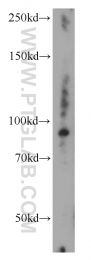 21640-1-AP - UNC45B