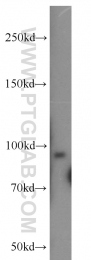 21640-1-AP - UNC45B