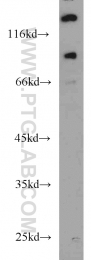 22068-1-AP - UNC5A