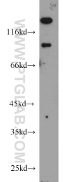 22068-1-AP - UNC5A