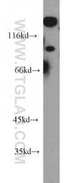 22068-1-AP - UNC5A
