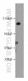20239-1-AP - UNC5A