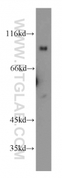 20239-1-AP - UNC5A