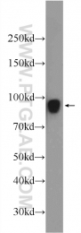 24568-1-AP - UNC84A