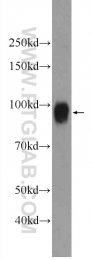 24568-1-AP - UNC84A