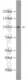 24568-1-AP - UNC84A