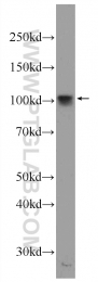 24568-1-AP - UNC84A