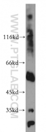 12394-1-AP - Uracil-DNA glycosylase (UNG)