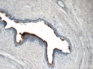 19733-1-AP - Uroplakin-2 (UPK2)