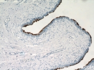 15709-1-AP - Uroplakin-3b (UPK3B)
