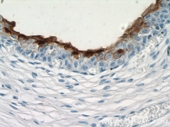 15709-1-AP - Uroplakin-3b (UPK3B)