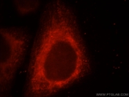 21705-1-AP - UQCRC1 (Complex III subunit core 1)