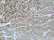 21705-1-AP - UQCRC1 (Complex III subunit core 1)