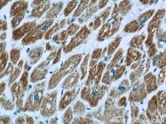 21705-1-AP - UQCRC1 (Complex III subunit core 1)