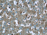 21705-1-AP - UQCRC1 (Complex III subunit core 1)