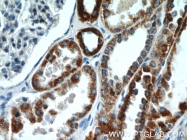 18443-1-AP - UQCRFS1 (Complex III subunit Rieske)