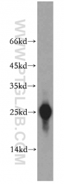 18443-1-AP - UQCRFS1 (Complex III subunit Rieske)