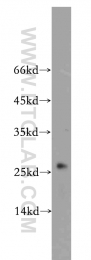 18443-1-AP - UQCRFS1 (Complex III subunit Rieske)