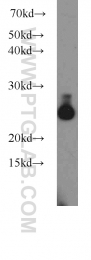 18443-1-AP - UQCRFS1 (Complex III subunit Rieske)