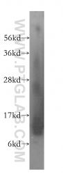 14975-1-AP - UQCRQ