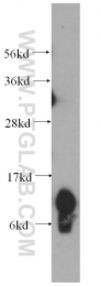 14975-1-AP - UQCRQ