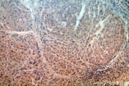 15285-1-AP - URM1