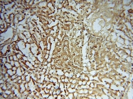 15285-1-AP - URM1