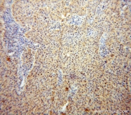 14346-1-AP - USP1