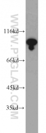 14346-1-AP - USP1