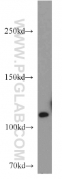 10244-1-AP - USP11