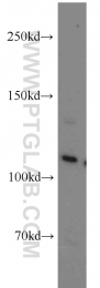 10244-1-AP - USP11